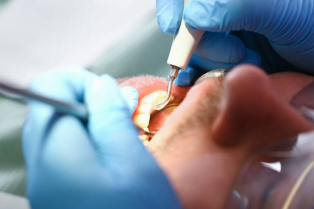 Professional Emergency Dental Service in KS