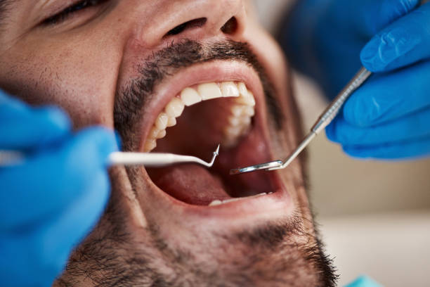 Best 24-Hour Emergency Dental Care in Syracuse, KS